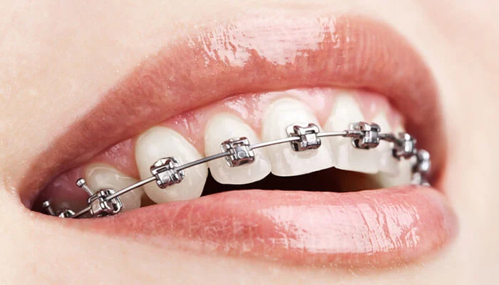 Carpenter Orthodontics- Fred W Carpenter DDS Picture 2