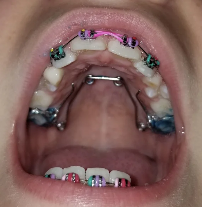 Imagine Orthodontics Picture 5