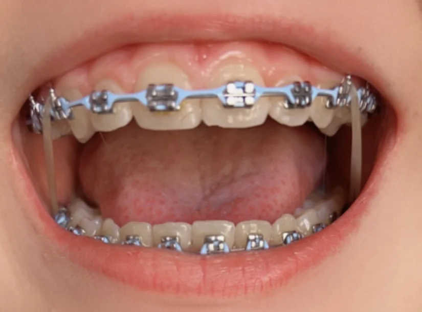 Imagine Orthodontics Picture 3