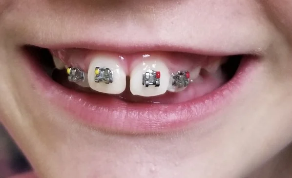 Imagine Orthodontics Picture 6
