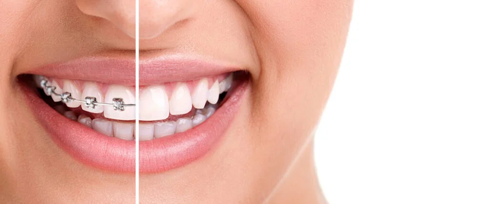 Imagine Orthodontics Picture 4
