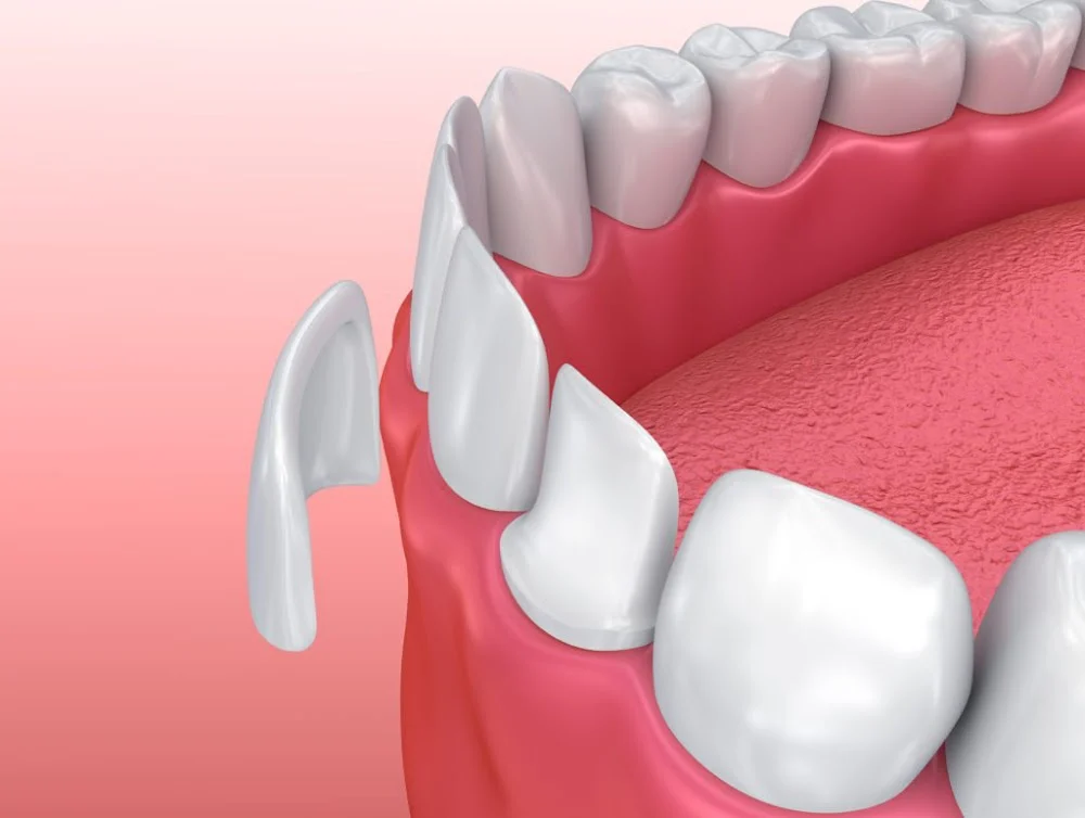 Castor Dental Care Picture 5