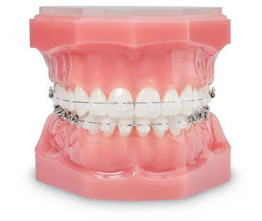 KC Braces + Kids Picture 3