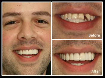 Dental Arts Group - Northeast Philadelphia Picture 7