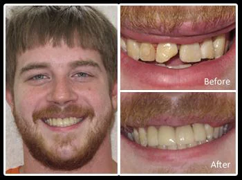 Dental Arts Group - Northeast Philadelphia Picture 2
