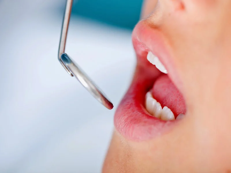 NE Philly Dentistry Picture 2