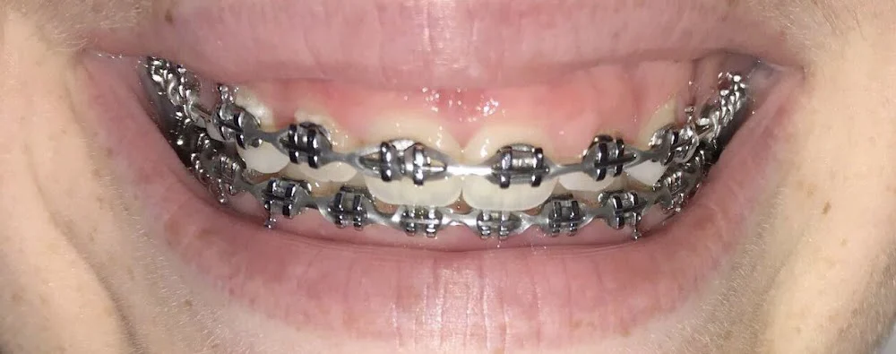 Handsman & Haddad Periodontics, P.C. Picture 6