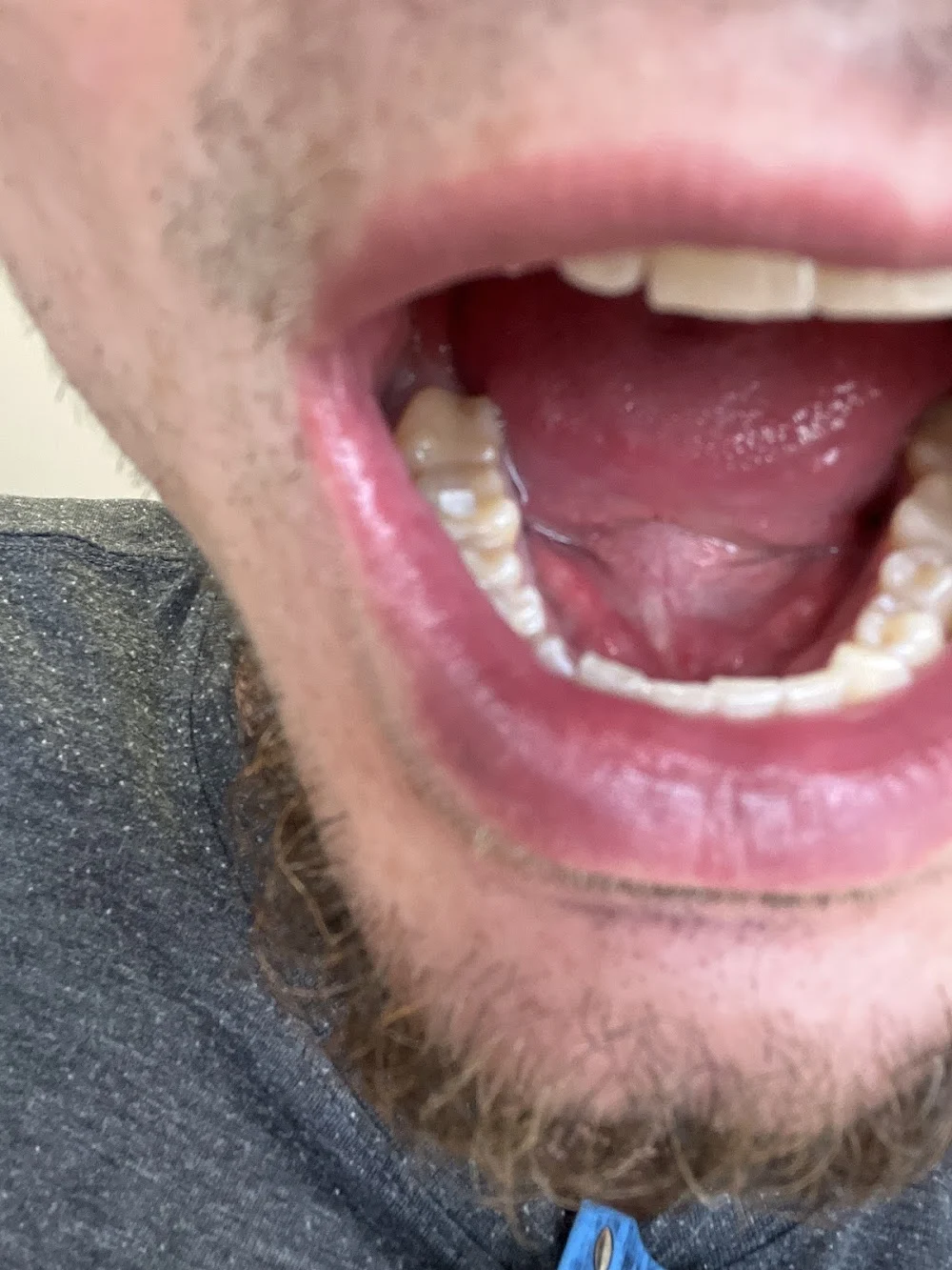 Naperfield Endodontics Picture 4