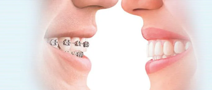 Class One Orthodontics Picture 2
