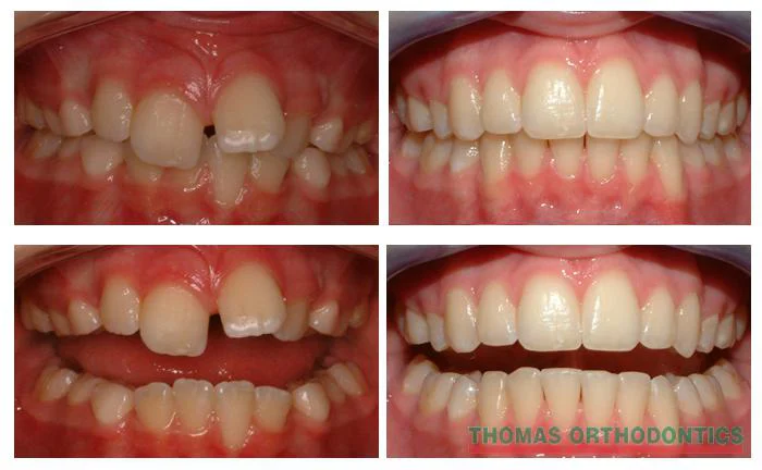 Thomas Orthodontics Picture 10