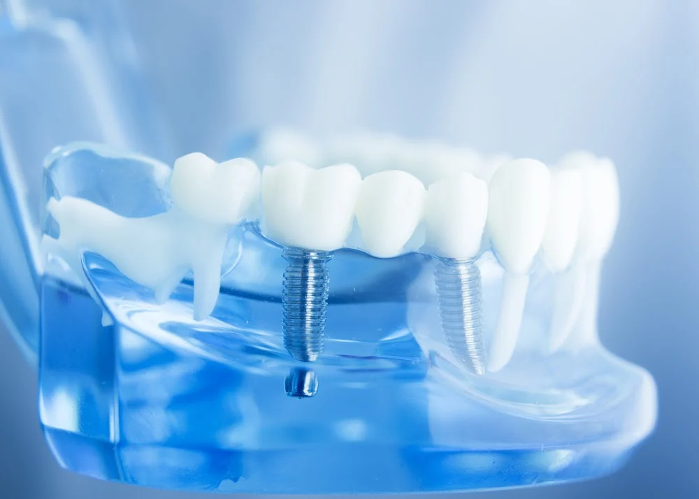Westford Dentistry Picture 6