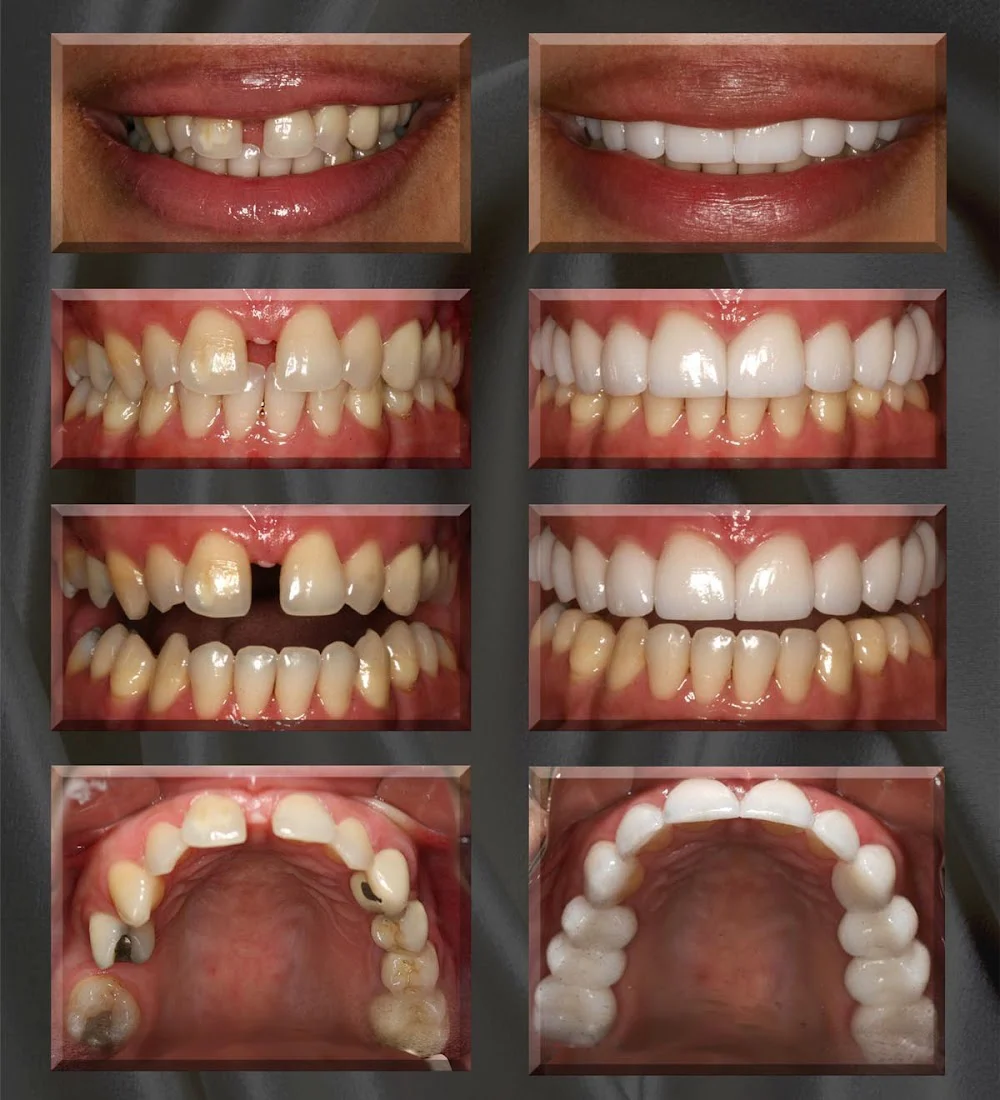 Advanced Dentistry of Collegeville Picture 6