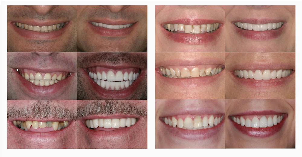 Perfect Smiles, PLLC, Dr. Houghton, Dr. Tamminidi, Dr. Sai Picture 6