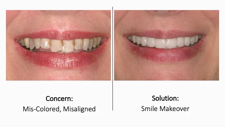 Perfect Smiles, PLLC, Dr. Houghton, Dr. Tamminidi, Dr. Sai Picture 5