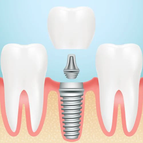 Pelham Family Dental Picture 8