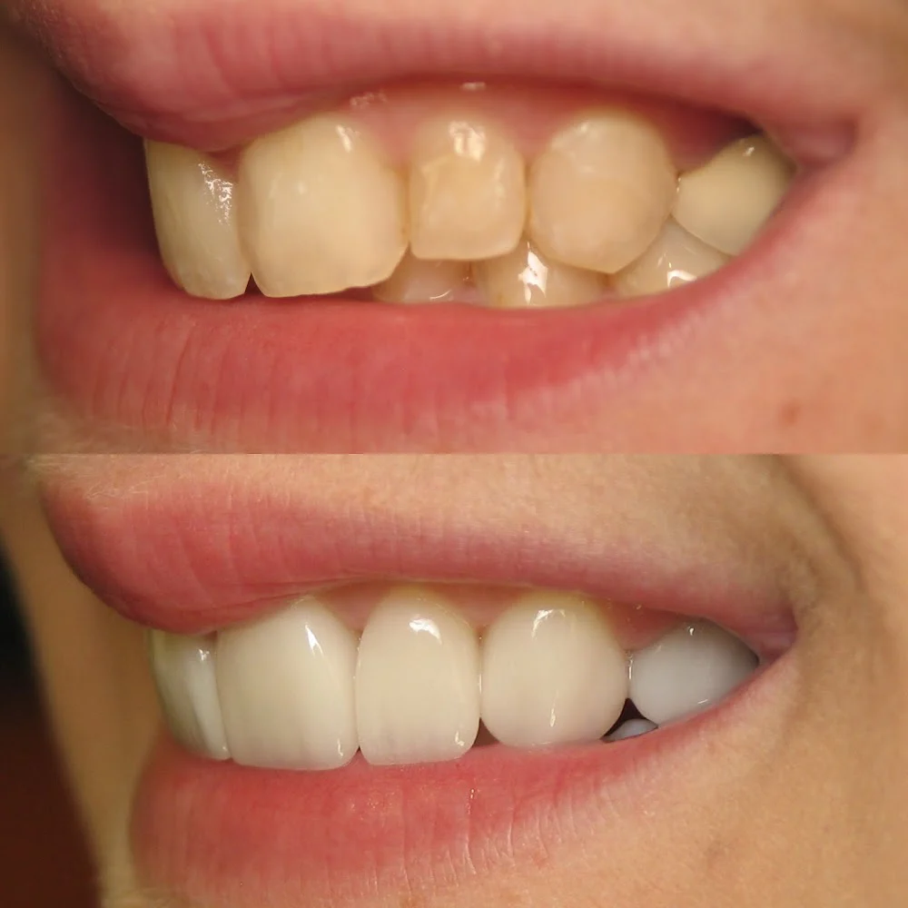 Future of Dentistry - Dracut Picture 4