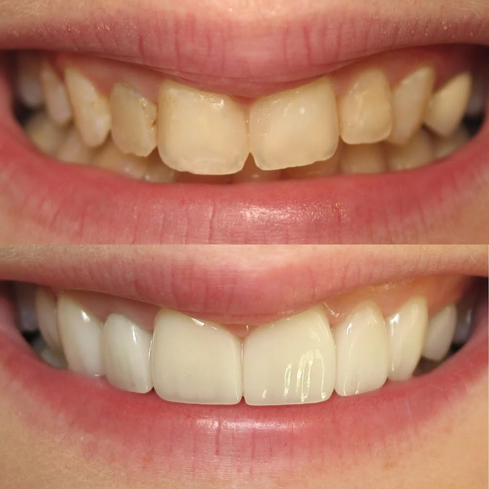 Future of Dentistry - Dracut Picture 9