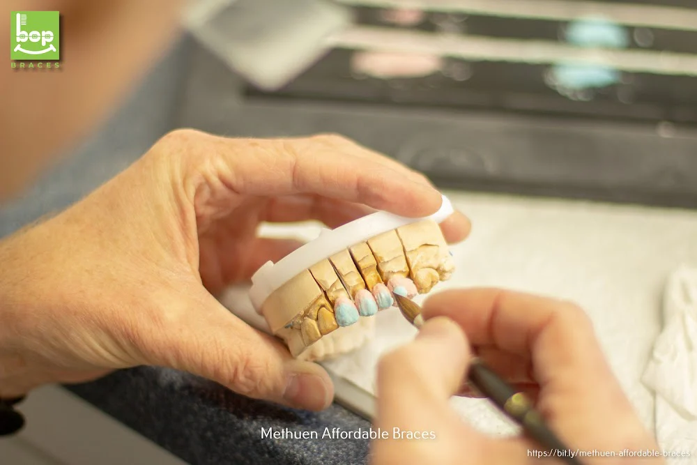 bop BRACES-Braces Orthodontics Pediatrics Invisalign Clear Braces Picture 10