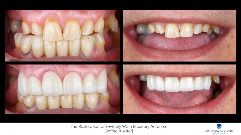 West Bridgewater Smiles Picture 10