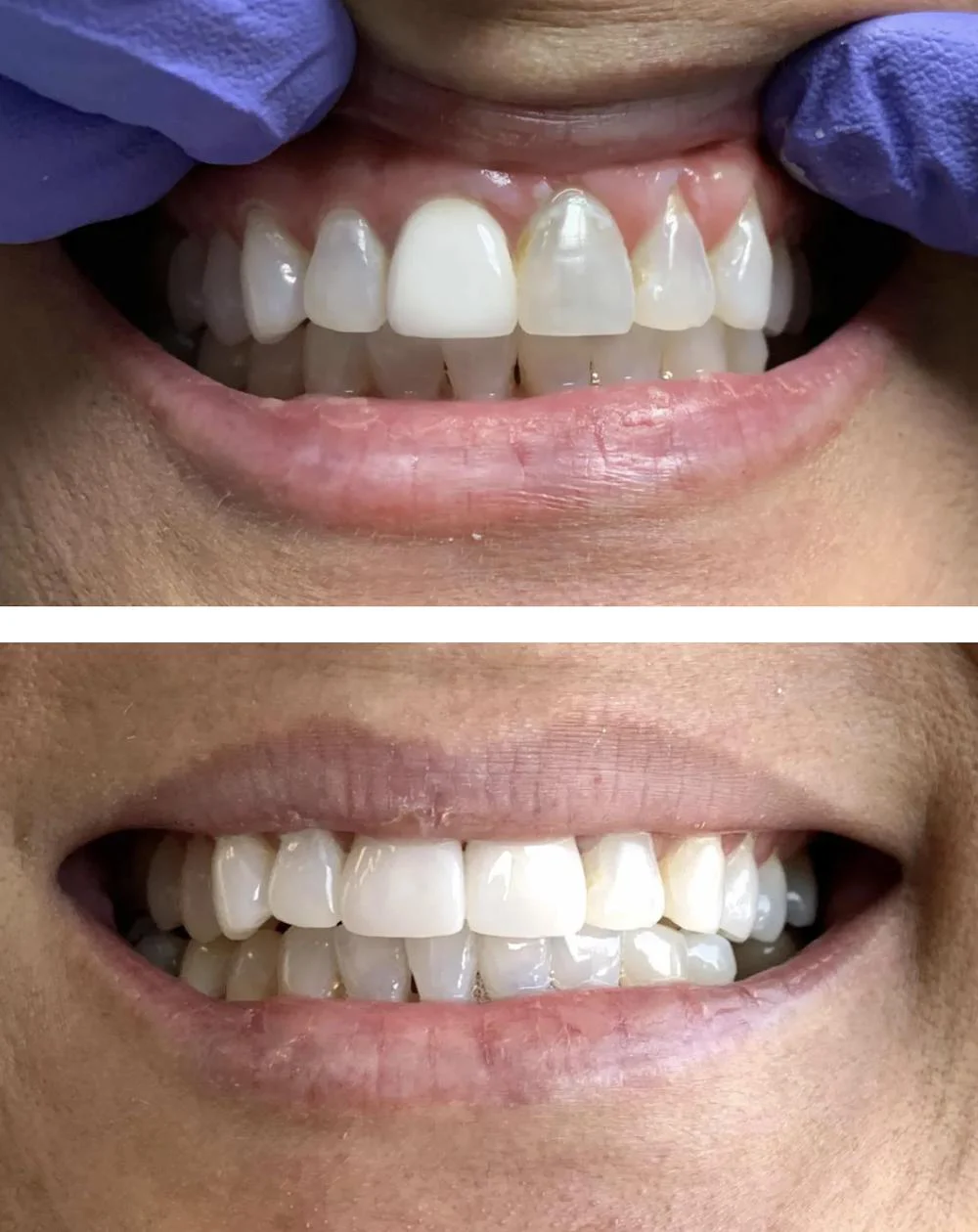 Buford Dental Picture 3