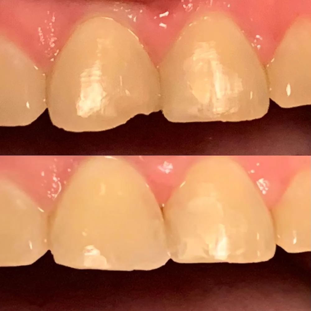Cumming Dental Smiles: Buford Highway Picture 4