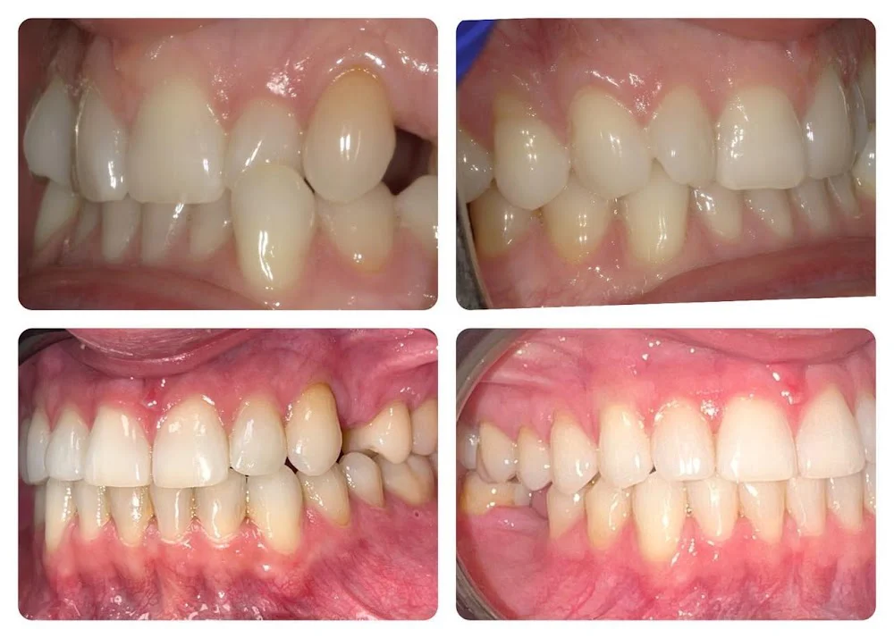 Lifetime Family Dental - Implant and General Dentistry Picture 10