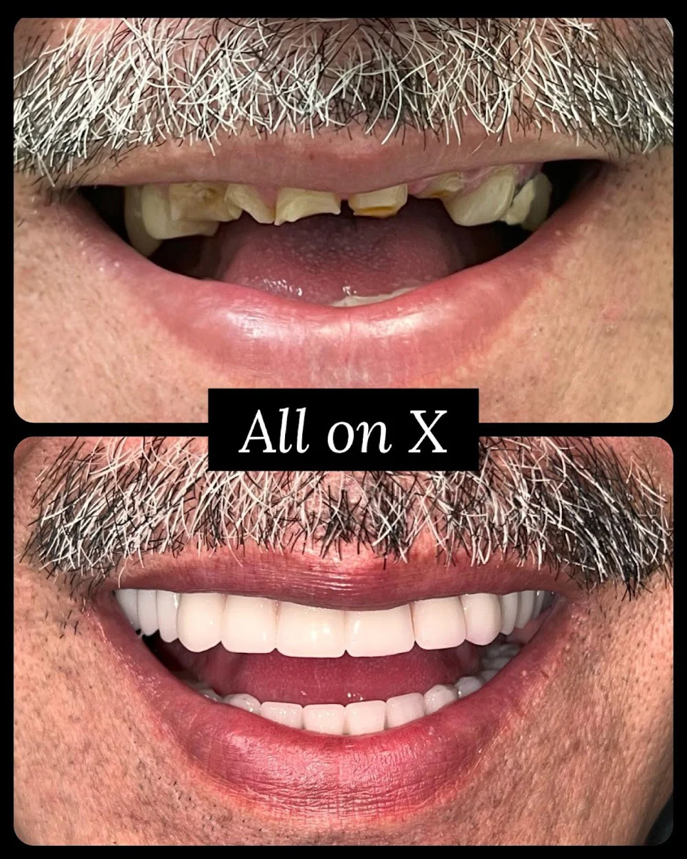 Lifetime Family Dental - Implant and General Dentistry Picture 6