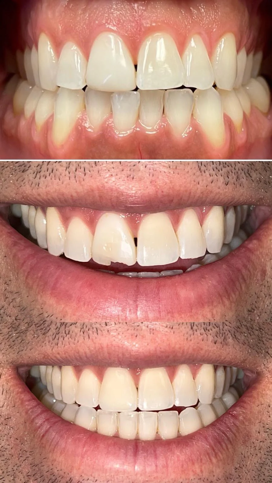 Lifetime Family Dental - Implant and General Dentistry Picture 5