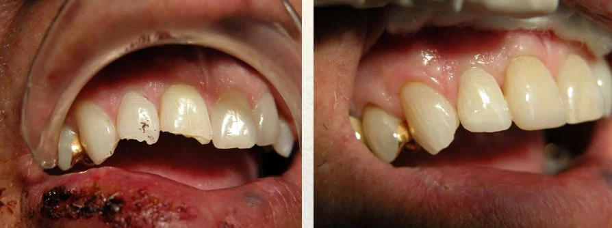 Murmann Dental Health Picture 8