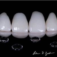 Ascend Dental - Dr. Zurek and Dr. Sikora ico