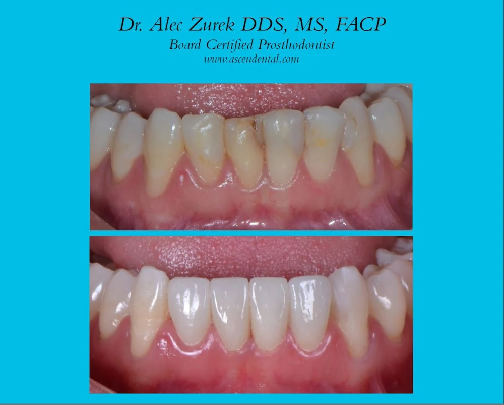 Ascend Dental - Dr. Zurek and Dr. Sikora Picture 7