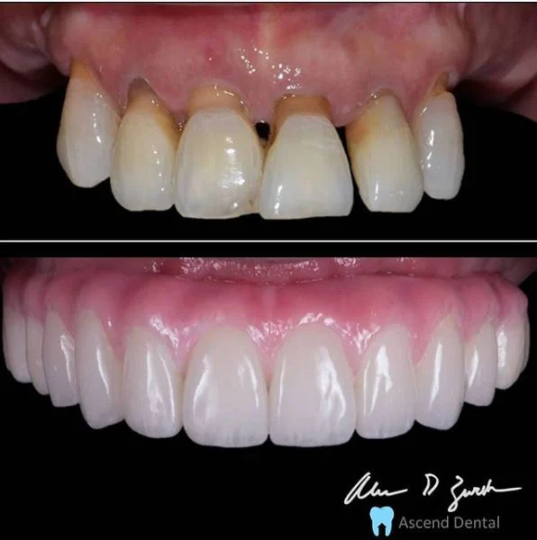 Ascend Dental - Dr. Zurek and Dr. Sikora Picture 8