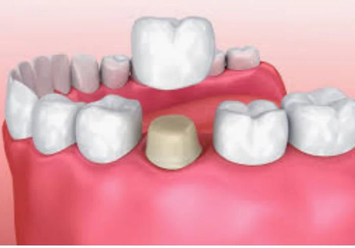 Smile Obsession Dental Picture 10
