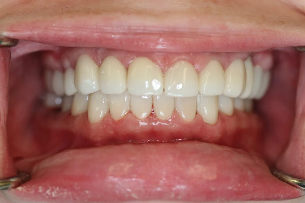 Northwest Implant Dental Spa Picture 1