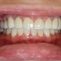 Northwest Implant Dental Spa ico