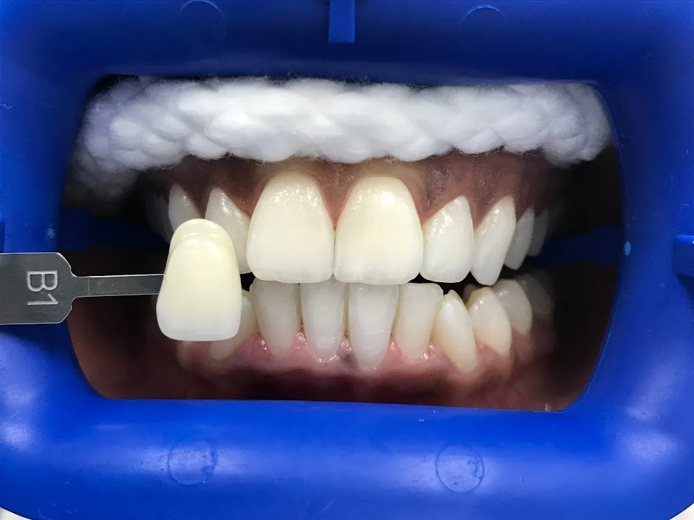 88 Smile Designs: Edly Destine, DDS Picture 4