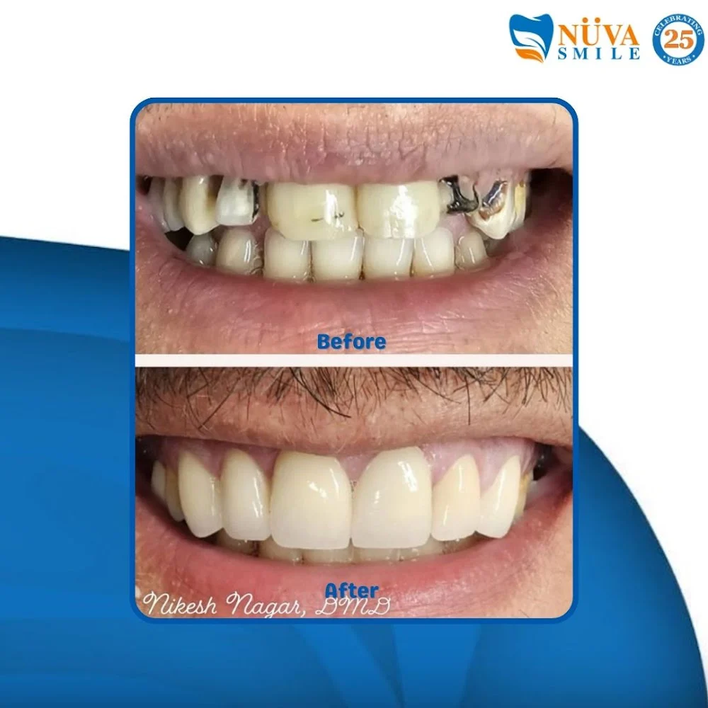 NÜVA Smile Picture 6