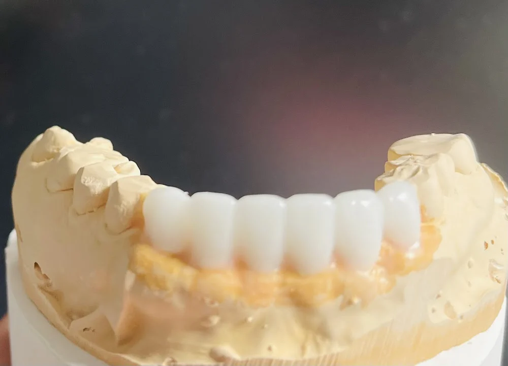 Blissful Dental Picture 4