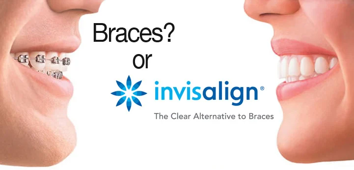 Nak4 Orthodontics Arlington Heights Picture 9