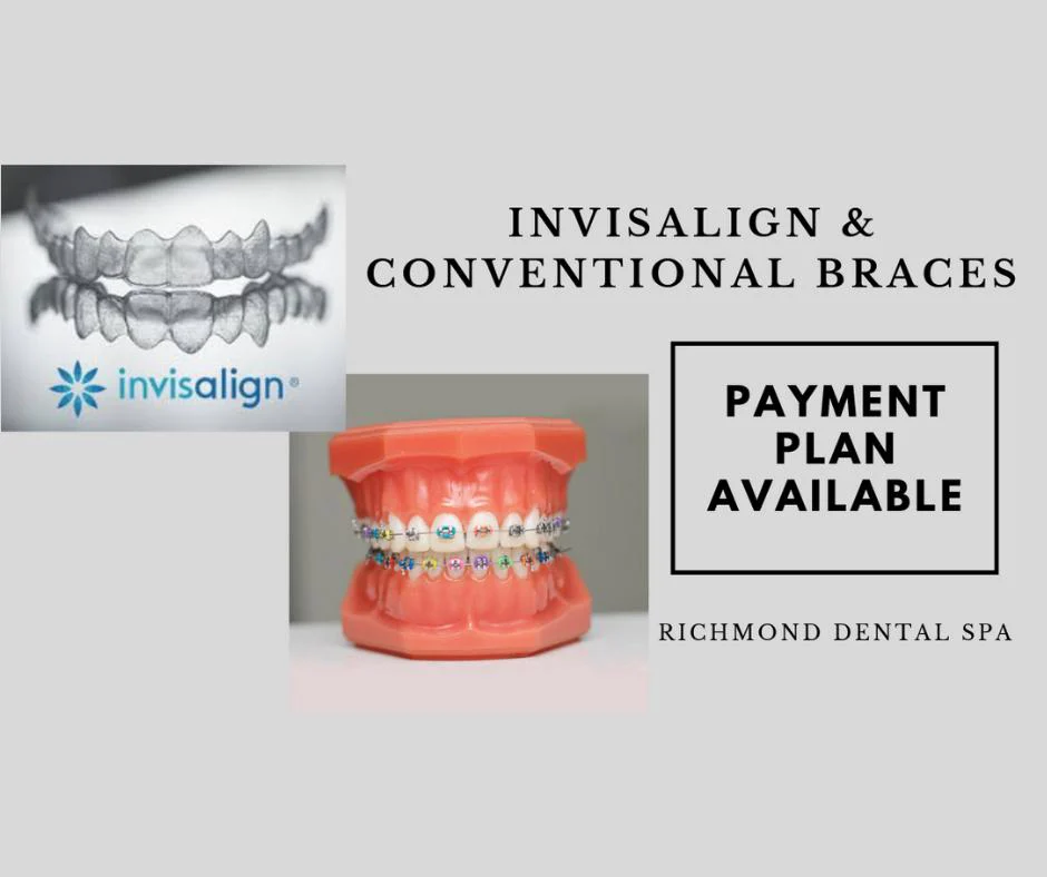 Dr. Firas Albadran, DDS. Dr. A | Richmond Dental Spa Picture 5