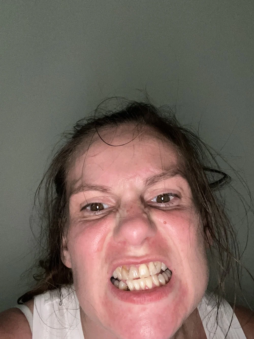Best Smiles Staples Mill Picture 8