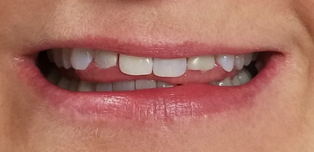 Pope Family Dental Picture 8