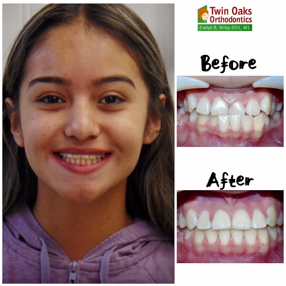 Twin Oaks Orthodontics Picture 10