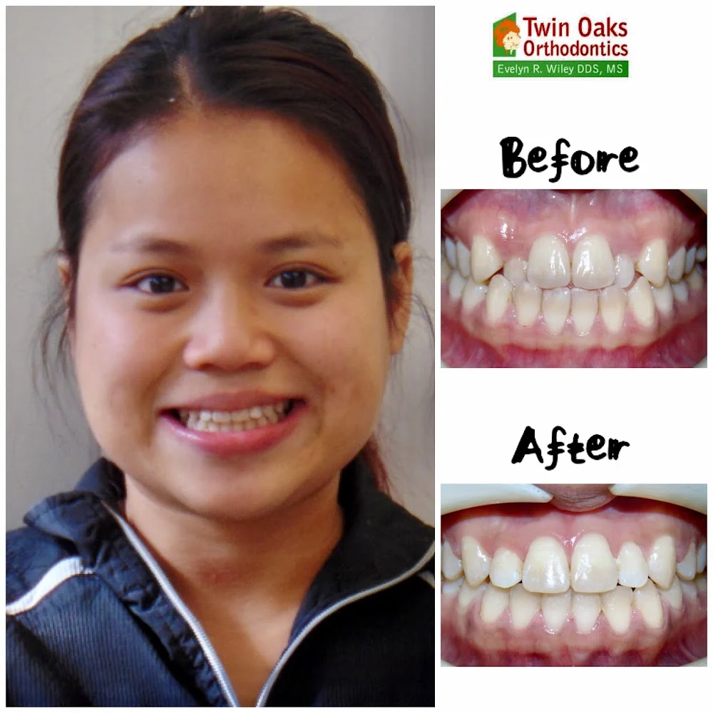 Twin Oaks Orthodontics Picture 9