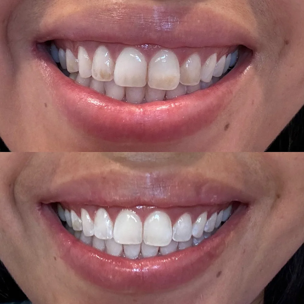 One Dental Tacoma Picture 8