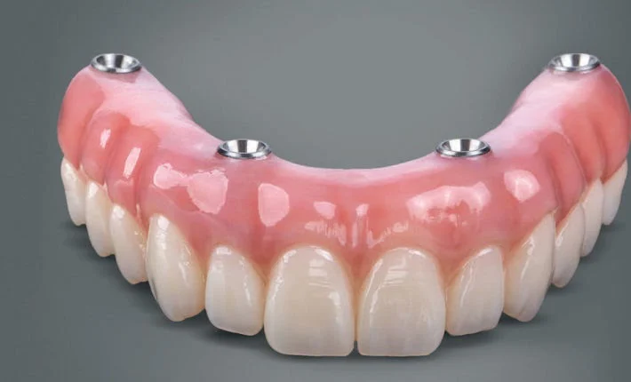 Puyallup Valley Dental Care Picture 4