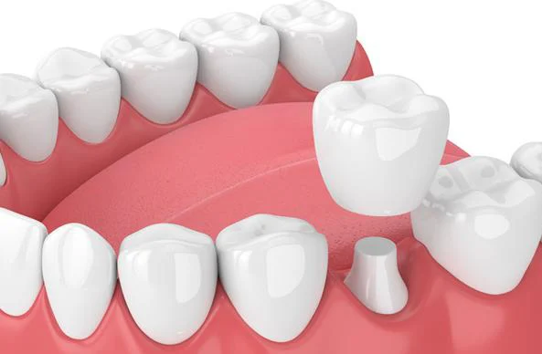 Puyallup Valley Dental Care Picture 3