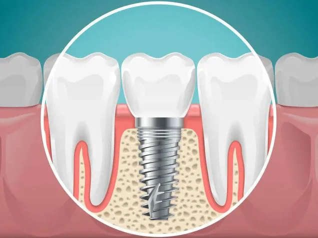 Puyallup Valley Dental Care Picture 9