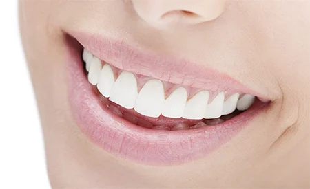 Puyallup Valley Dental Care Picture 6
