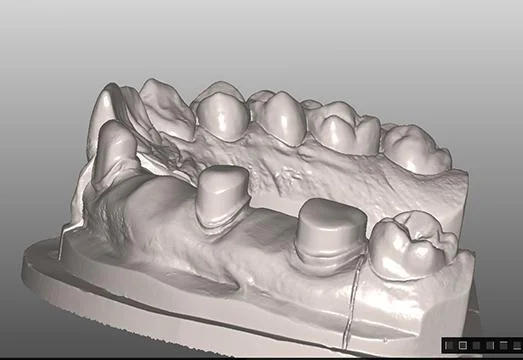 Puyallup Valley Dental Care Picture 10